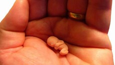 В Ирландии проходит референдум о праве на аборт