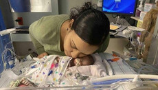Лікарі в США врятували двох недоношених пятимісячних близнят
