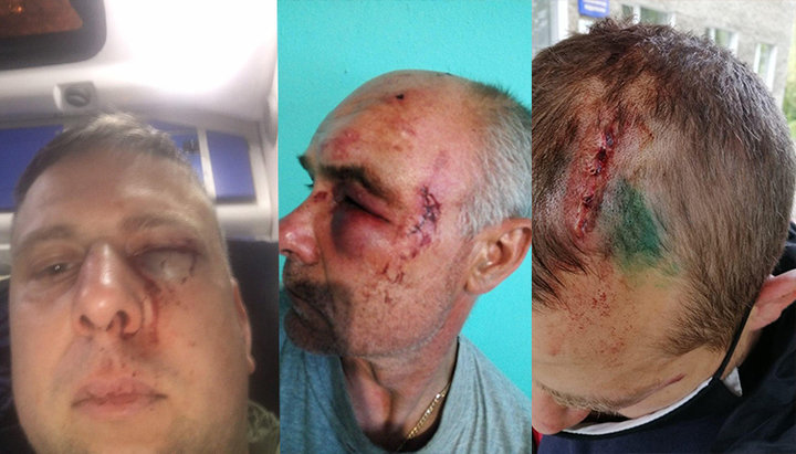 Θύματα επίθεσης ακτιβιστών της ΟCU από τον Ιερό Ναό της UOC στο Ζαντουμπρόβκα. Φωτογραφία: spzh.news