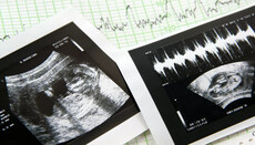 В РПЦ поддержали идею включения абортов в статистику смертности