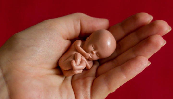 Новые законы должны сократить количество абортов в РФ. Фото иллюстративное: genomed.ru