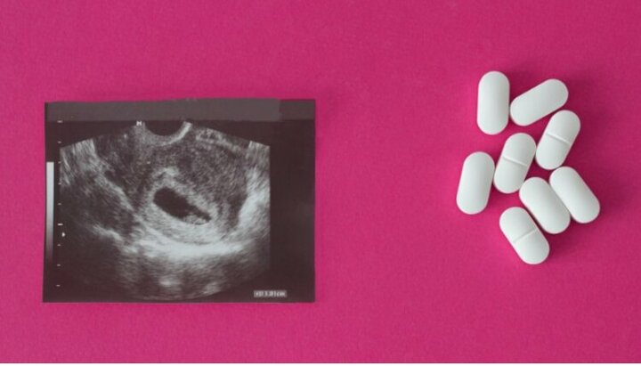 Таблетки для прерывания беременности. Фото: christianheadlines.com