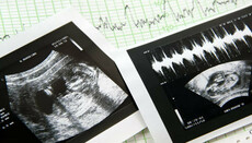В РПЦ предлагают исключить аборты из системы обязательного медстрахования