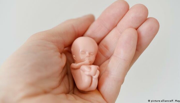 В Украине аборты разрешены. Фото: dw.com