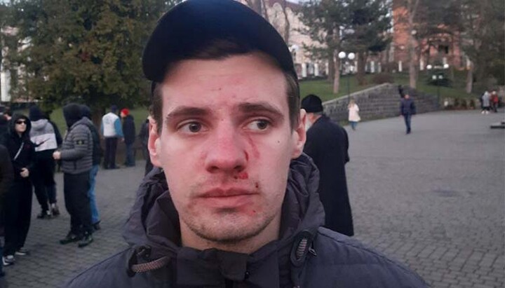 Un enoriaș rănit al parohiei catedralei Alexandru Nevski după atacul unui susținător al BOaU. Imagine UJO