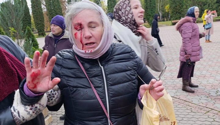 UOC believer injured during the storming of the cathedral. Photo: press service of the Cherkasy Eparchy